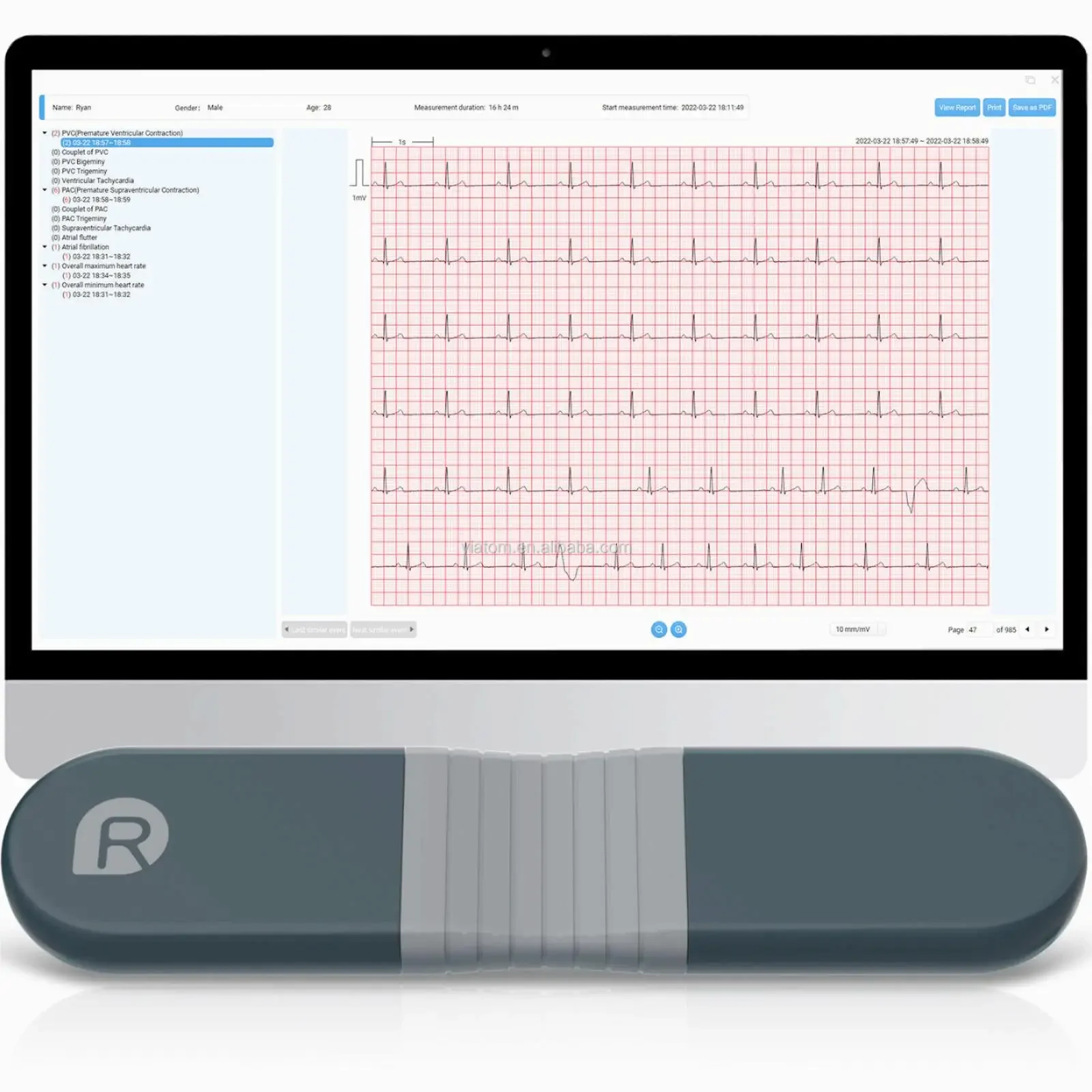 Gravador dinâmico sem fio Blue - Ecg Patch Monitor avaliação e preço